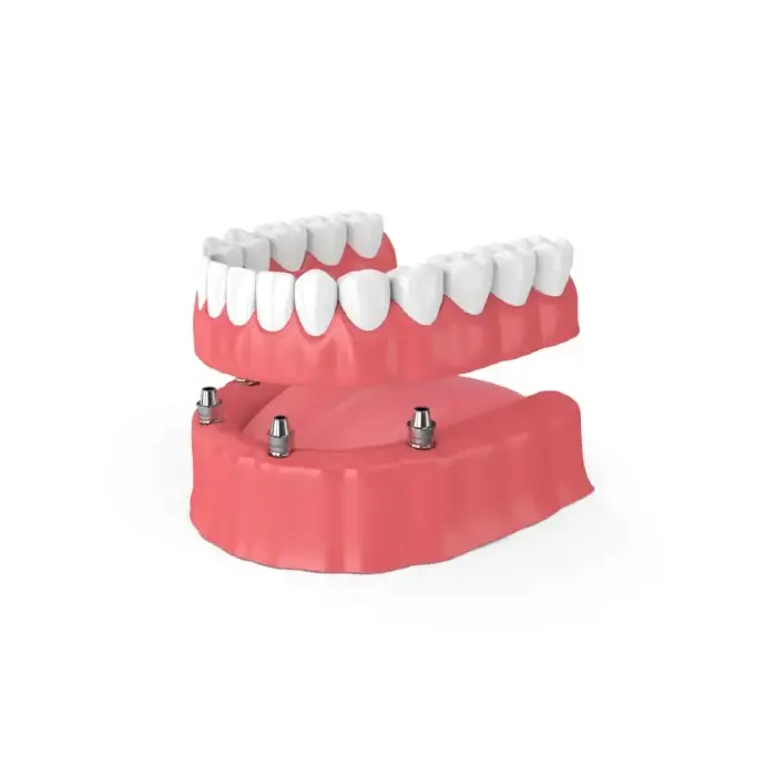 snap-in implant dentures Reno, NV
