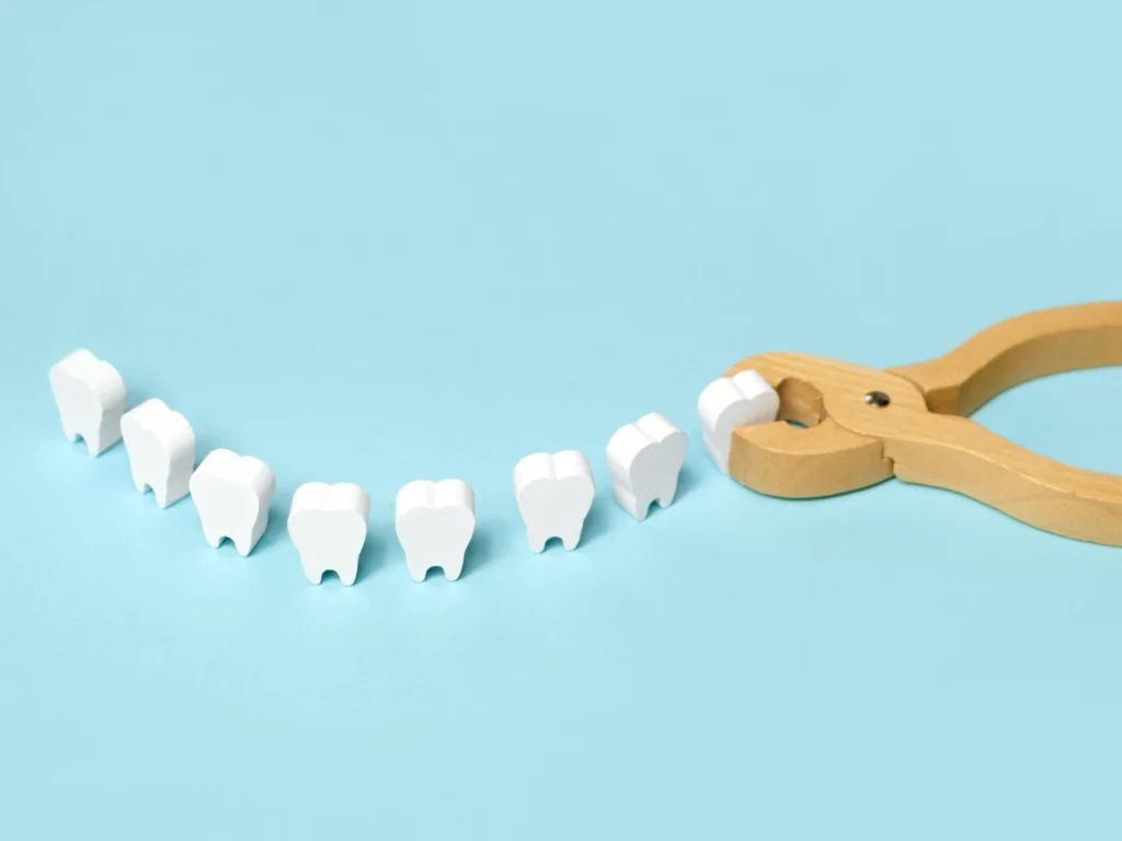emergency tooth extraction Reno, NV