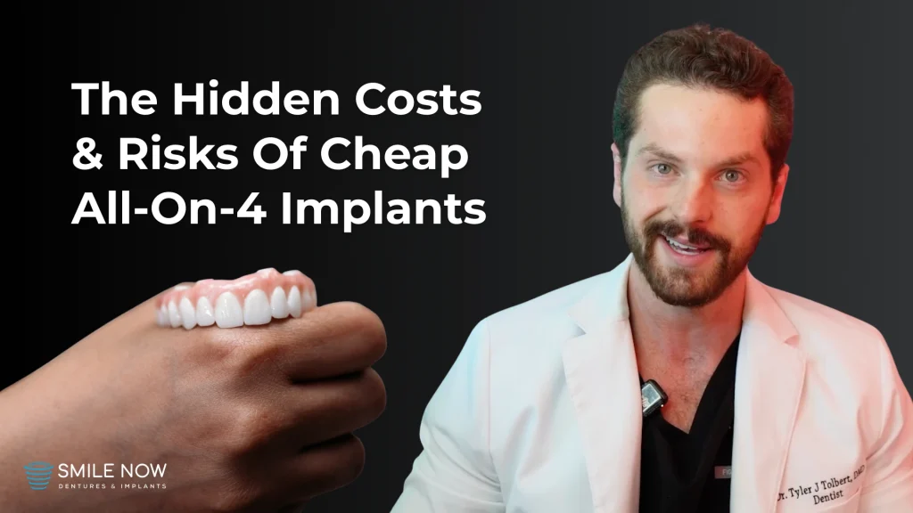 Thumbnail photo for a video about the real costs and risks of cheap all on 4 dental implants